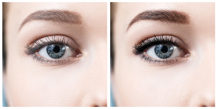 before after castor oil
