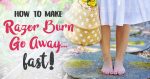 How to Make Razor Burn Go Away… Fast!